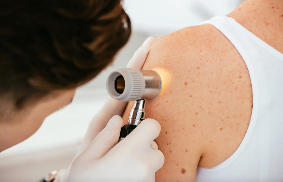 درمان سرطان پوست با mRNA خطر مرگ را در کارآزمایی بالینی به نصف کاهش می‌دهد  (یک پزشک)