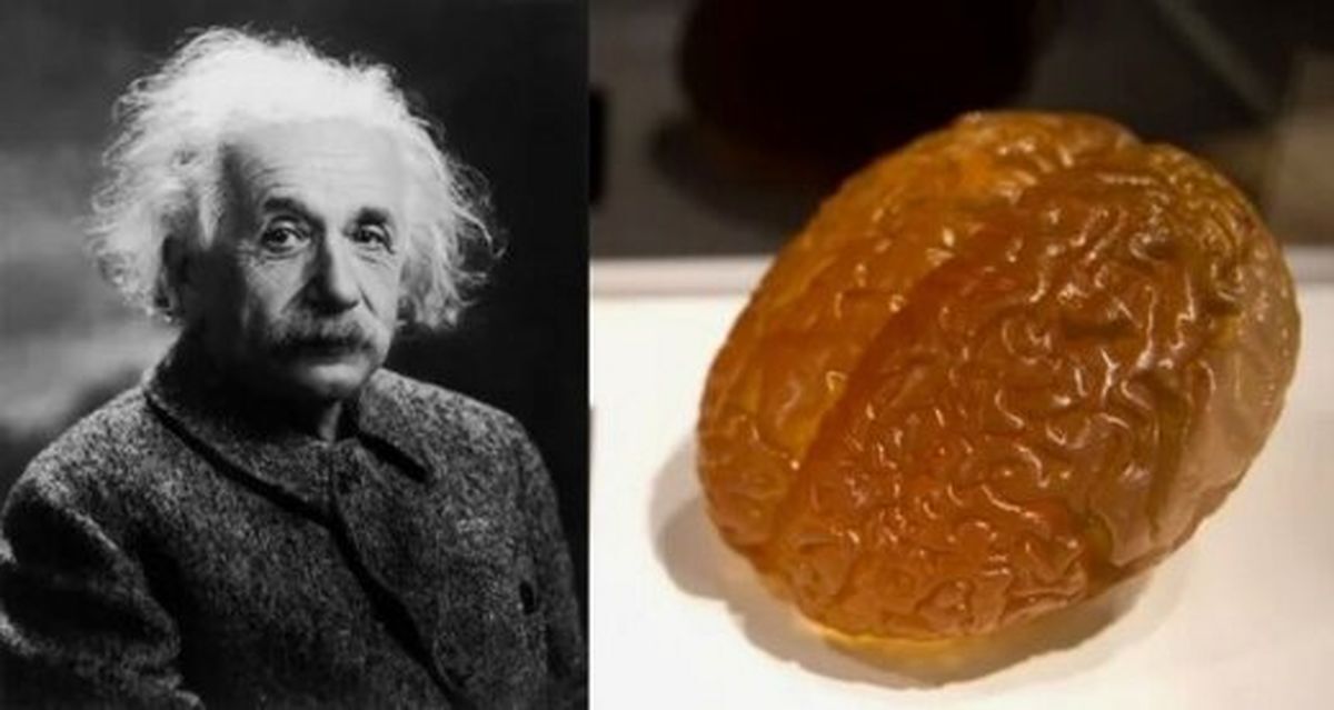 مغز آلبرت اینشتین در شیشه / چه تفاوتی با مغز دیگران مشاهده شد (عصرایران)