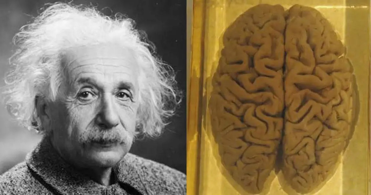 تصویری از مغز آلبرت اینشتین در شیشه 