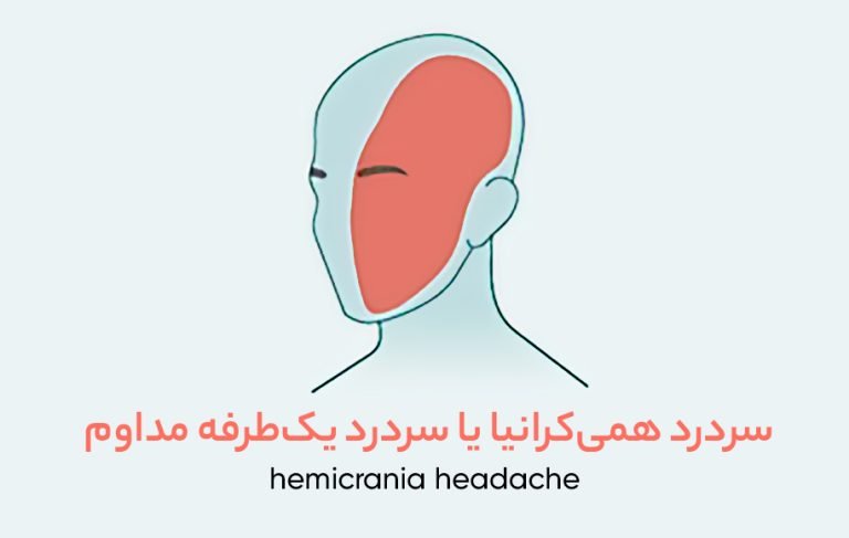درد در هر بخش از سر نشانه‌ی چیست؟ (انواع سردرد بر اساس محل درد (دیجی کالا مگ)