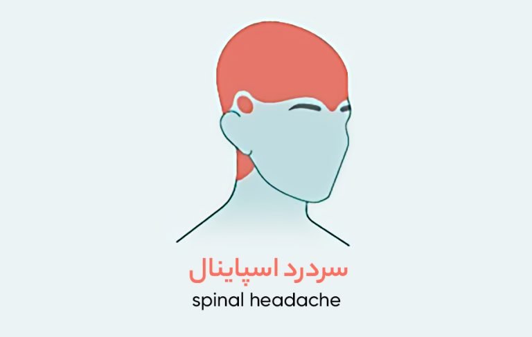 درد در هر بخش از سر نشانه‌ی چیست؟ (انواع سردرد بر اساس محل درد (دیجی کالا مگ)