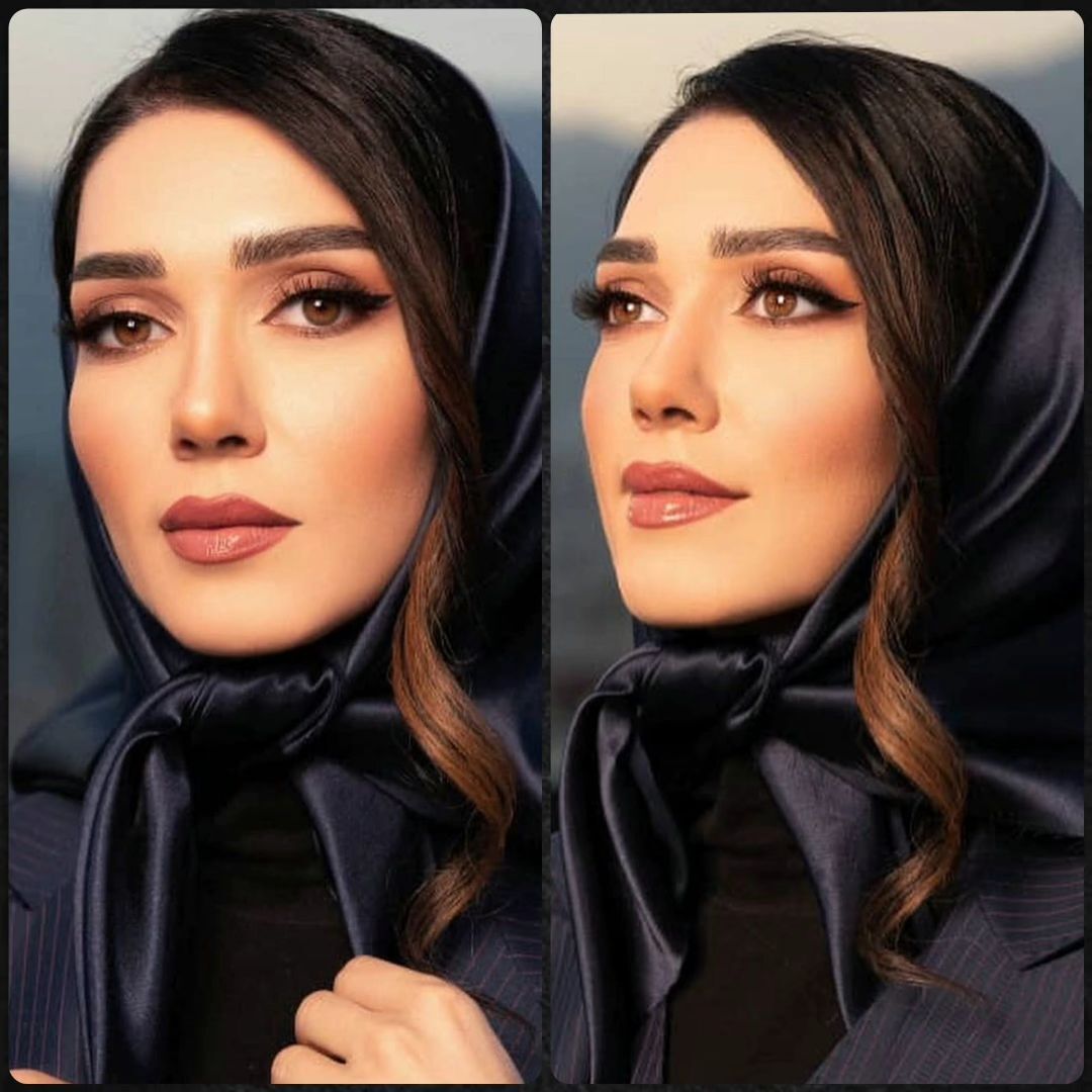تغییر چهره شهرزاد کمال‌زاده در عکس جدیدش