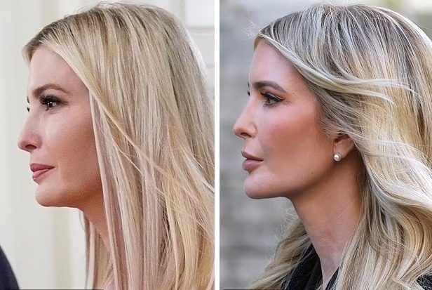 تغییر چهره دختر رئیس‌جمهور سابق تعجب برانگیز شد