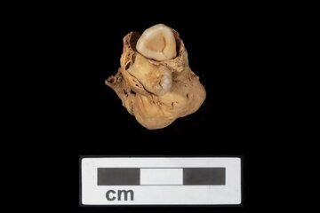 کشف دو دندان عجیب در جسد زن ۳ هزار ساله