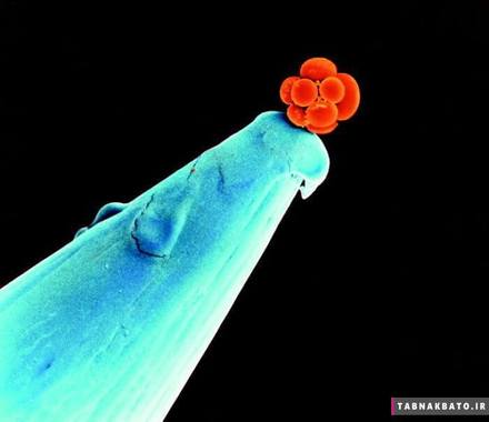 جنین انسان در مراحل ابتدایی شکل گیری, مجموعه ای از سلول ها نوک سوزن