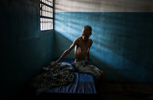 ونزوئلا: شرایط بد نگهداری از این بیماری مبتلا مبتلا به شیزوفرنی در یک بیمارستان