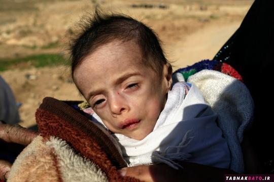 بتول بشیر احمد، کودک پنج ماهه ای که از دهیدراتاسیون شدید (از دست دادن آب بدن) رنج می برد، در آغوش مادرش در حال خروج از مناطق تحت تسلط داعش می باشد.