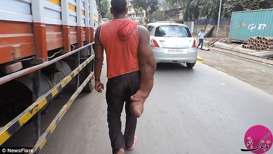 جوان هندی با دست 20 کیلوگرمی