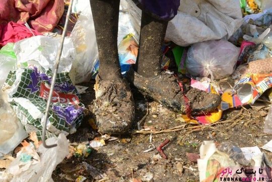 هندوستان، فرو رفتن پاهای یک زن درون زباله های قابل بازیافت، در حاشیه حیدرآباد