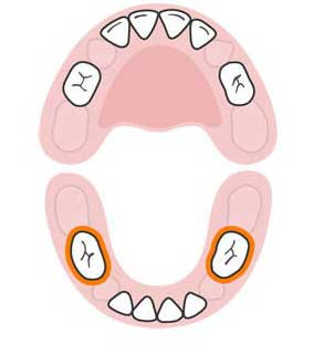 با ترتیب رشد دندان های کودکتان آشنا شوید