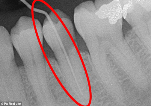 مشکل عجیب یک زن پس از مراجعه به دندانپزشکی+عکس