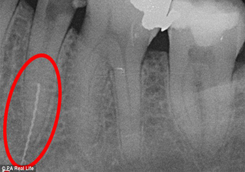 مشکل عجیب یک زن پس از مراجعه به دندانپزشکی+عکس