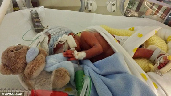 ماجرای نوزادی که 100 روز برای زندگی جنگید + تصاویر