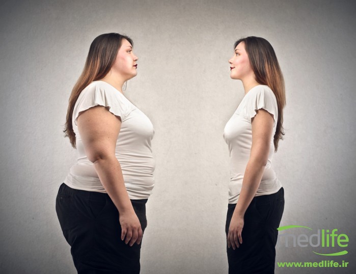 4 دلیل دلیل عمده چاقی در ناحیه شکم و دور کمر