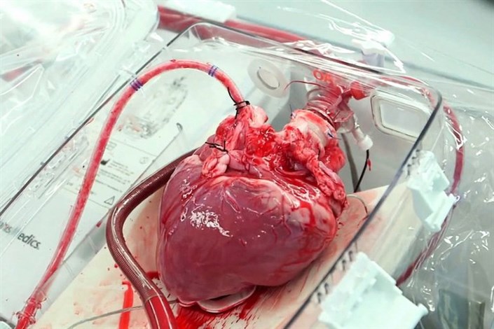گزارش مهیج و دیدنیِ انتقال قلب اهدایی