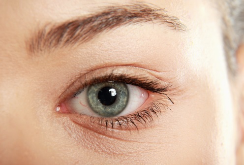 درمان چروک و خطوط پنجه کلاغی در اطراف چشم