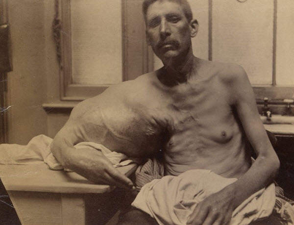 تاریخ پزشکی در ۱۰۰ هزار عکس – مجموعه باارزشی که Wellcome Images منتشر کرده است