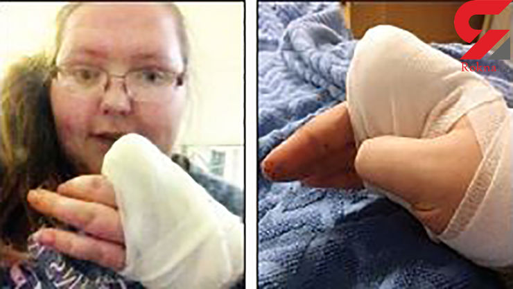 زن جوان از شدت درد انگشتش را با تبر قطع کرد +عکس