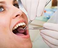 جرم گیری دندان چرا و چگونه؟