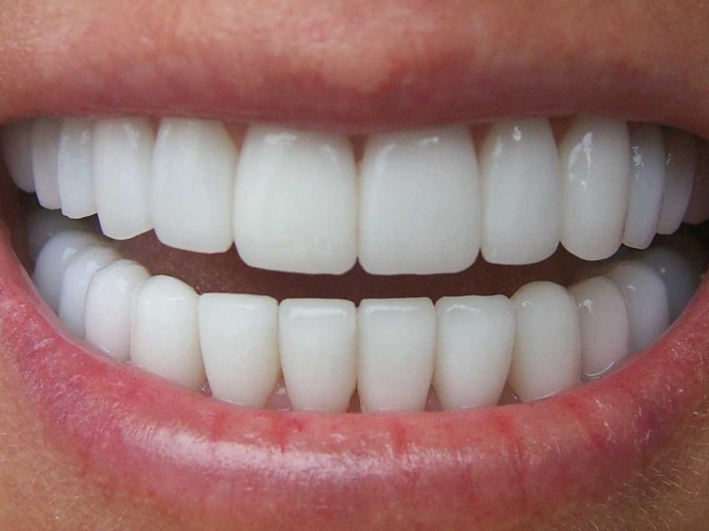 جرم گیری دندان چرا و چگونه؟