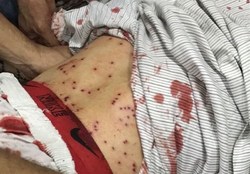 شیوع بیمار‌های پوستی در زندان مرکزی «جو»