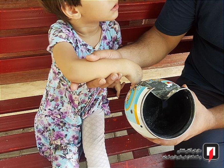 گیرکردن دست کودک در سوراخ کتری +عکس