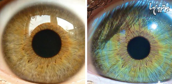 چیز‌های عجیبی که رنگ چشمتان را عوض می‌کنند+عکس