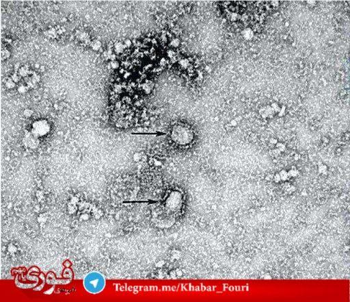 اولین تصویر میکروسکوپی از ویروس کرونا +عکس