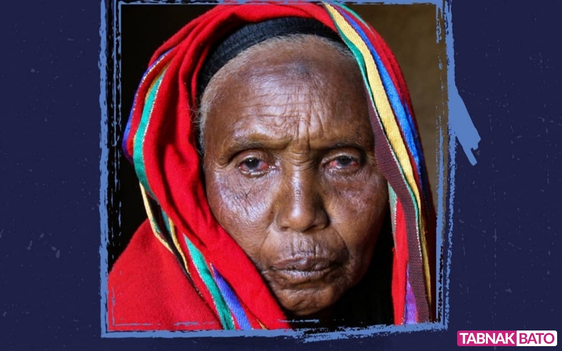 انتشار بیماری مرموز در اتیوپی