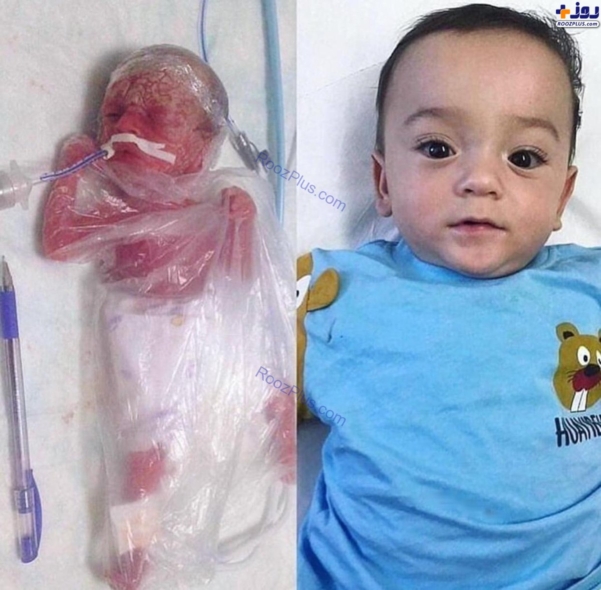 نوزادی که پزشکان از او قطع امید کرده بودند + عکس