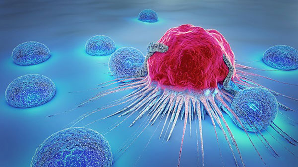 انواع سرطان بر اساس سلول‌های مهاجم