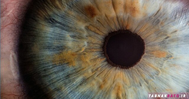 درمان نابینایی با استفاده از تولید سلول‌های شبکیه چشم