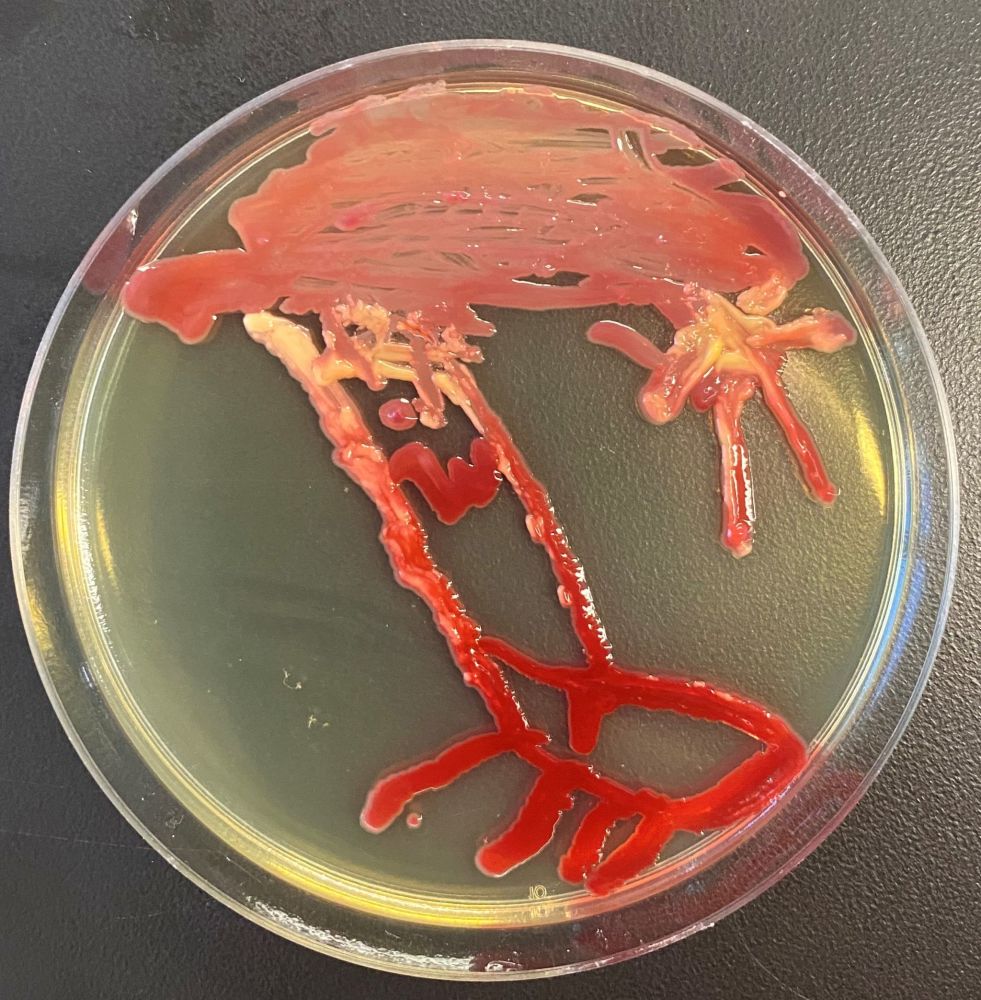 خلق آثار هنری با استفاده ازمیکروب و باکتری
