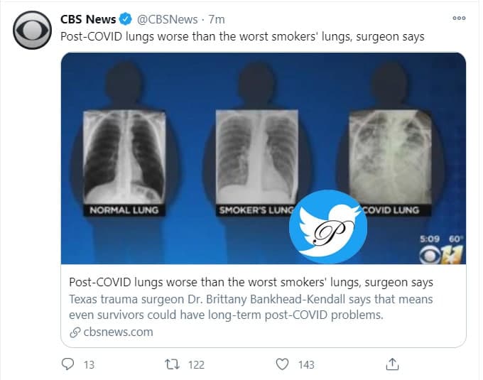 ریه بازماندگان کرونایی وحشتناک تر از افراد سیگاری+عکس