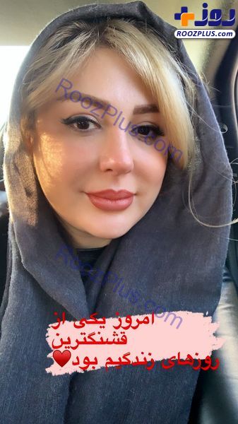 چهره متفاوت نیوشا ضیغمی بعد از جراحی زیبایی+عکس