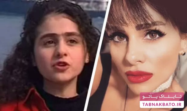 تغییر چهره باور نکردنی خواننده معروف آذربایجان
