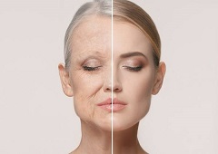 فوری از شل شدن پوست صورتت جلوگیری کن