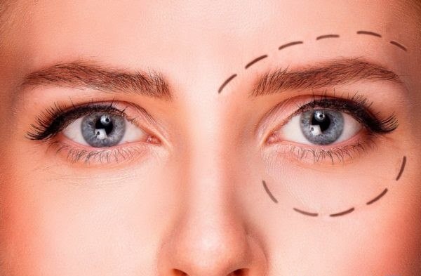 روشی برای برطرف کردن افتادگی پلک برای حفظ زیبایی چشم ها