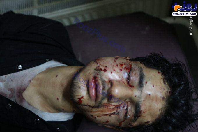مجروح شدن دلخراش عزاداران حسینی+عکس +۱۶