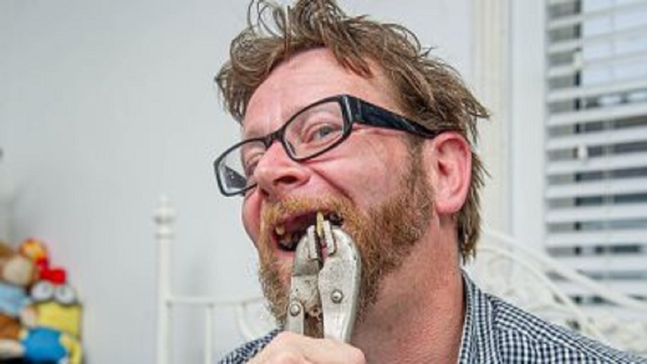 اقدام وحشتناک کارگر انگلیسی به دلیل بسته بودن دندانپزشکی +عکس
