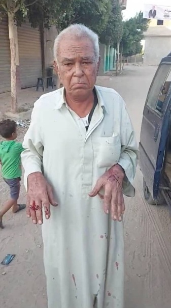 حمله وحشیانه پسر به پدر سالمندش خشم مردم را برانگیخت +عکس