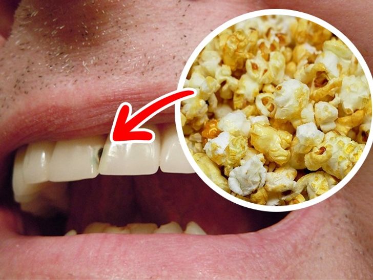 مضرترین مواد غذایی برای دندان ها کدام هستند؟