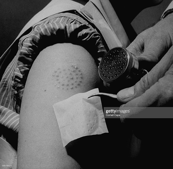 ماندگارترین تصاویر طرح واکسیناسیون در تاریخ+عکس