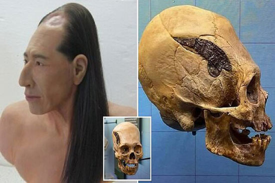 شواهدی از جراحی جمجمه در ۲هزار سال قبل