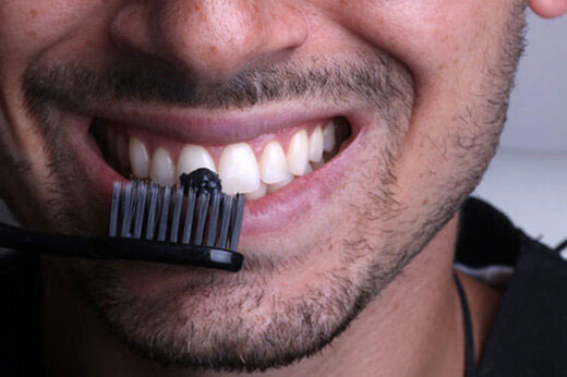 سفید کردن دندان‌ها چه خطراتی دارد؟