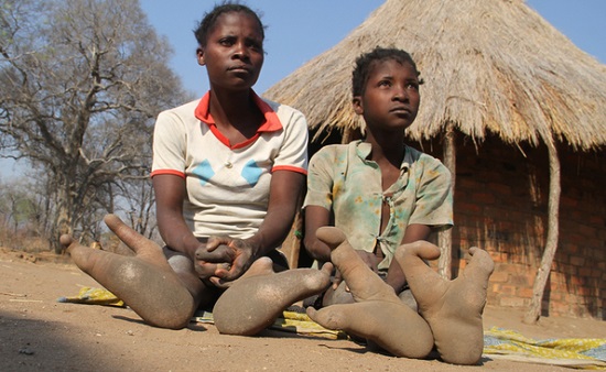 یک قبیله آفریقایی با پاهای عجیب اما واقعی