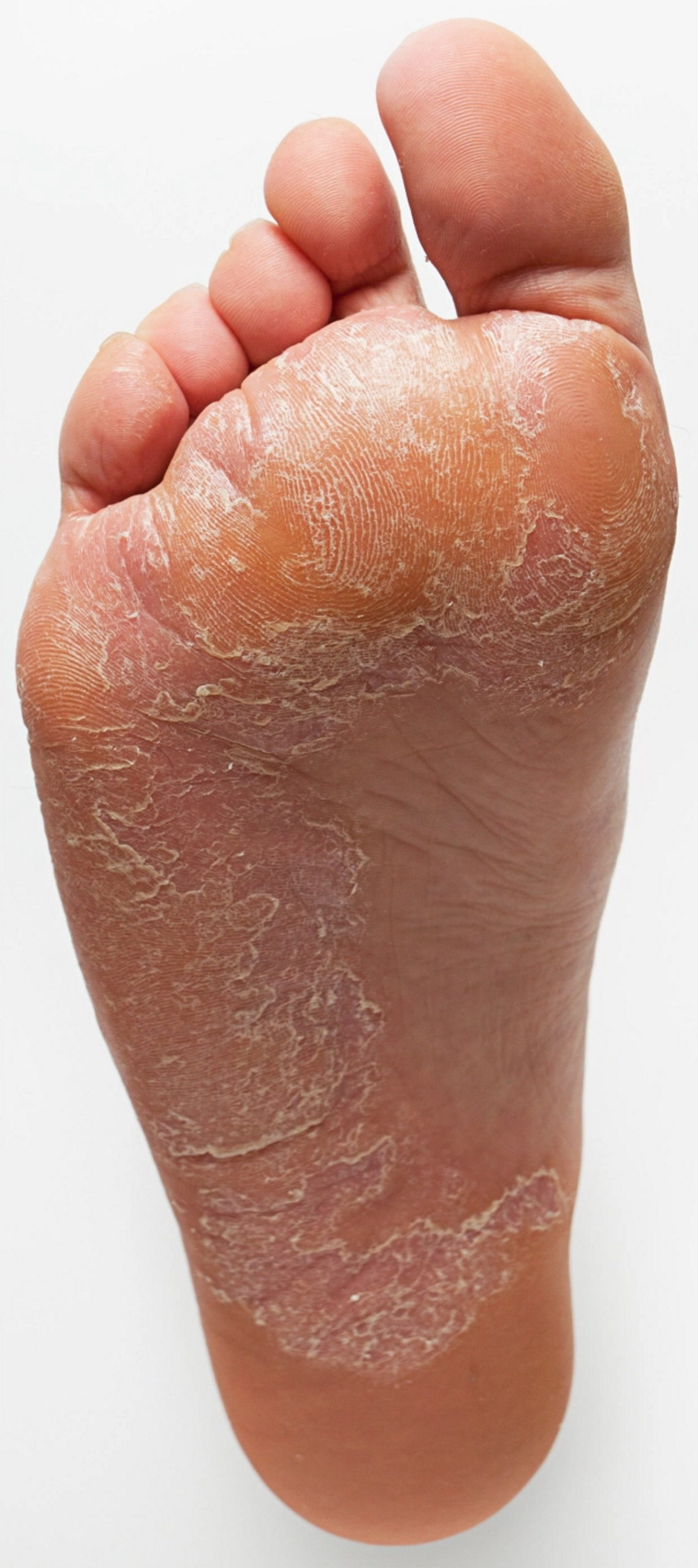 شکل و رفتار پاهای شما چه بیماریهای از درون شما را آشکار می‌سازد؟