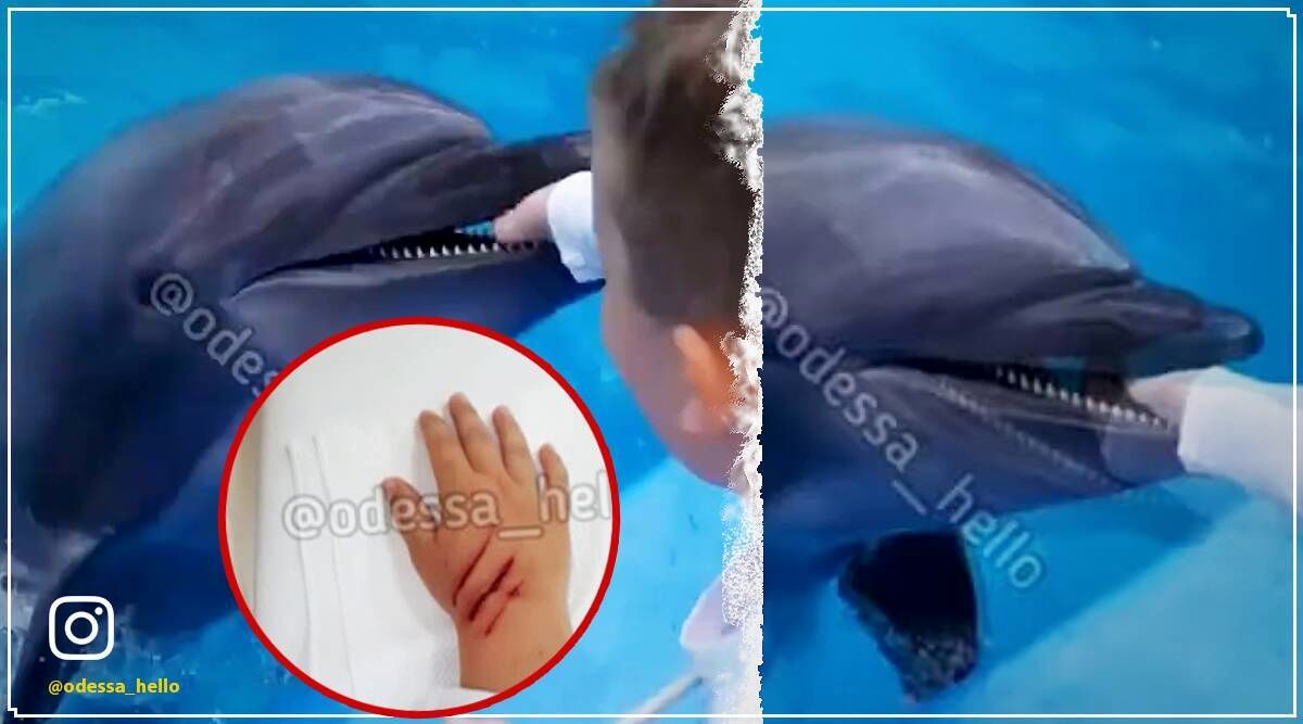 حمله غافلگیرانه دلفین، کودک را زخمی کرد +عکس