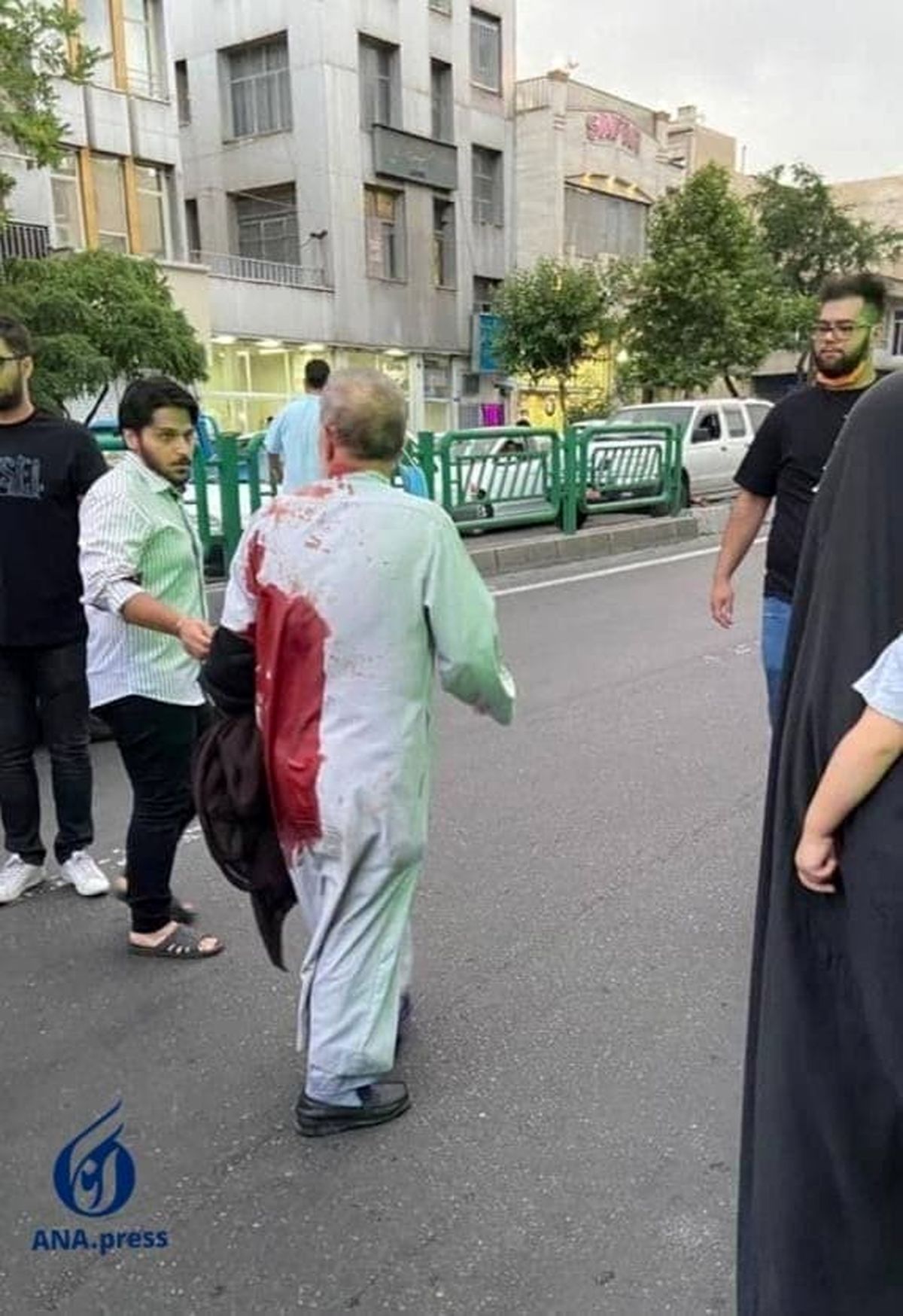 حمله به یک روحانی در تهران+ عکس