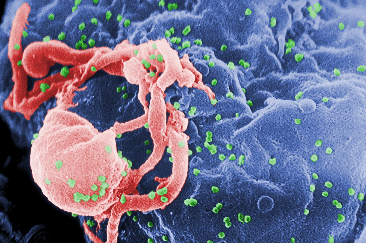 چگونه ویروس HIV منتشر می‌شود و راه های درمان آن چیست؟